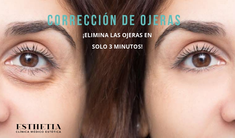 eliminación de ojeras - clínica Esthetia